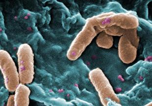 Чревни бактерии ни диктуват какво да ядем